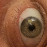 Thumb img 704f5fa564