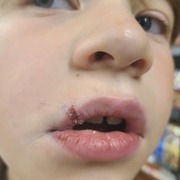 Thumb img c511fbf7df